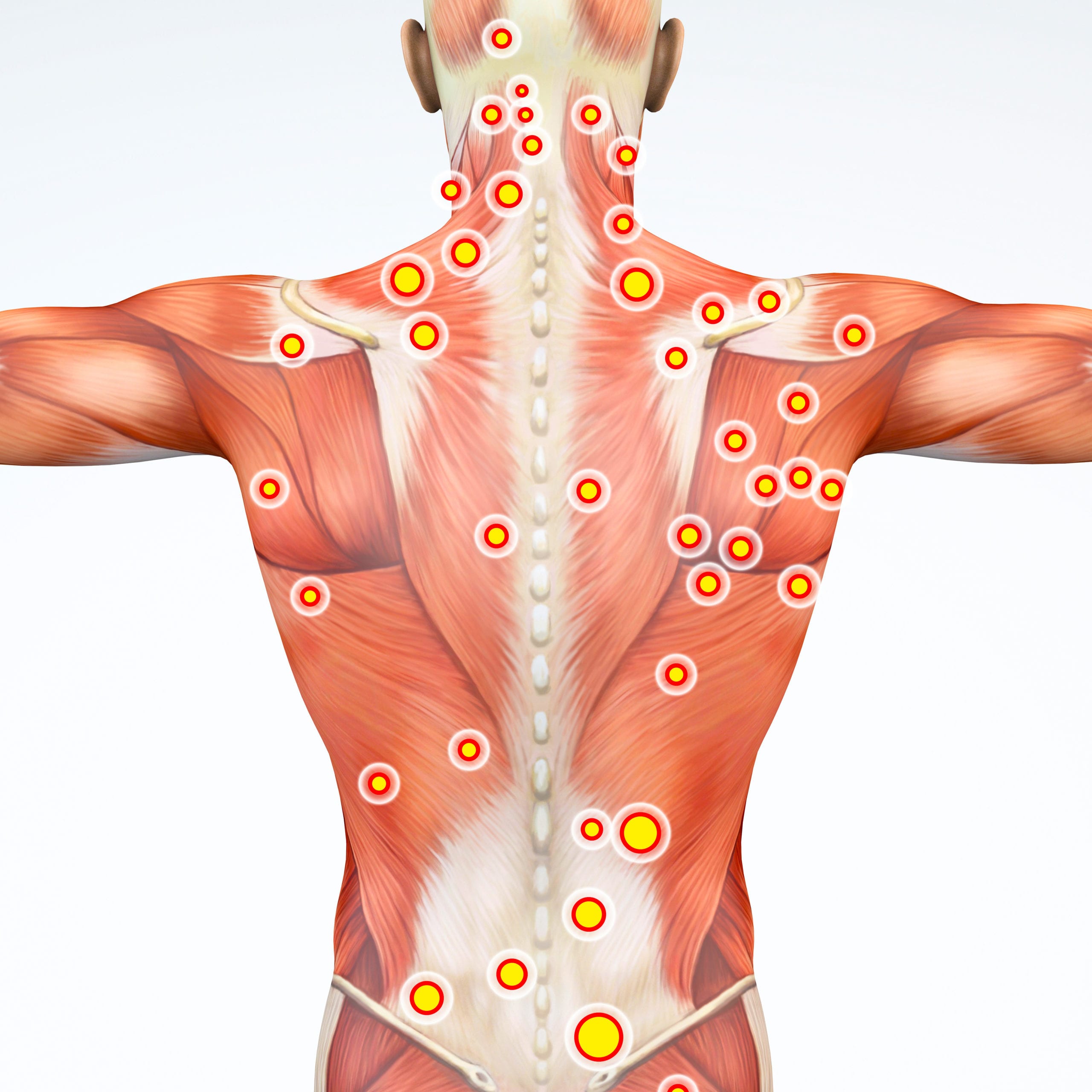 Dry Needling Near Me Services North Boulder Physical Therapy